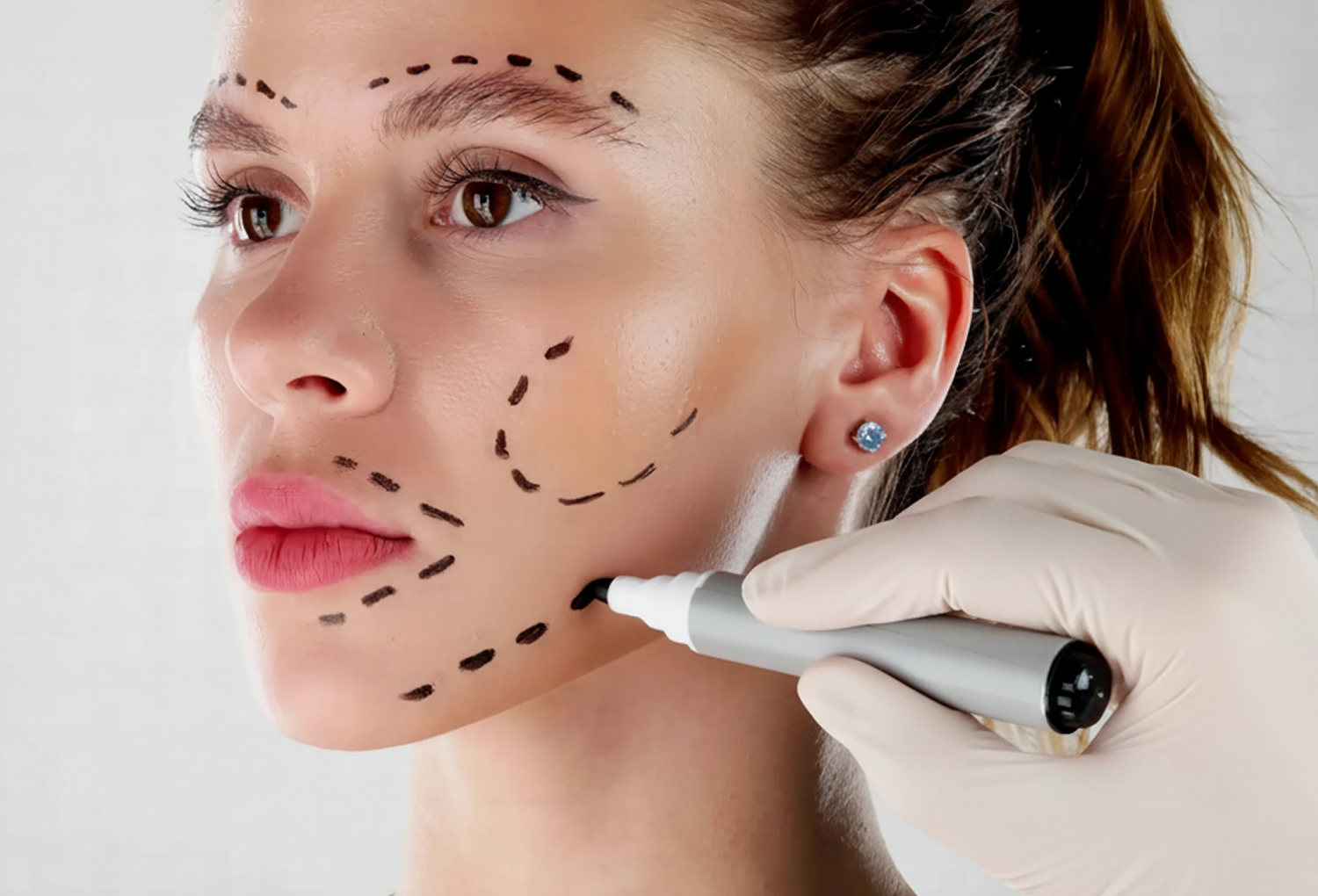 Facelift Surgery